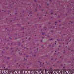 Non-neoplastic liver (matching CS) nonspecific reactive change