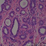 Normal matching tissues of MB Breast 03