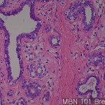Normal matching tissues of MB Breast