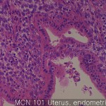 Normal matching tissues of MC Unterus endometrium