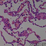 Normal lung (matching CC) Lung 02