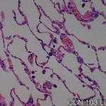 Normal lung (matching CC) Lung 03