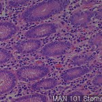 Normal matching tissues of MA stomach