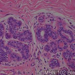 Normal matching tissues of MB Breast 02